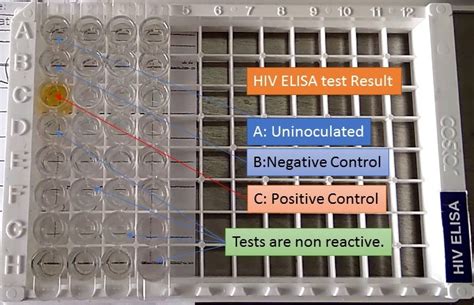 elisa test accuracy|elisa test results explained.